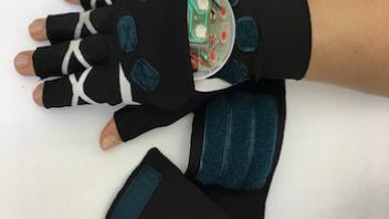 Development of a Therapeutic Smart Glove to Alleviate Rheumatoid Arthritis Symptoms