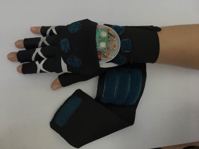 Development of a Therapeutic Smart Glove to Alleviate Rheumatoid Arthritis Symptoms 
