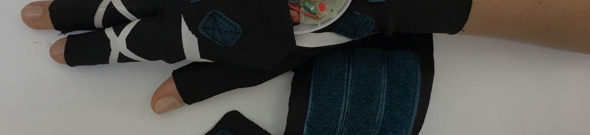 Development of a Therapeutic Smart Glove to Alleviate Rheumatoid Arthritis Symptoms 